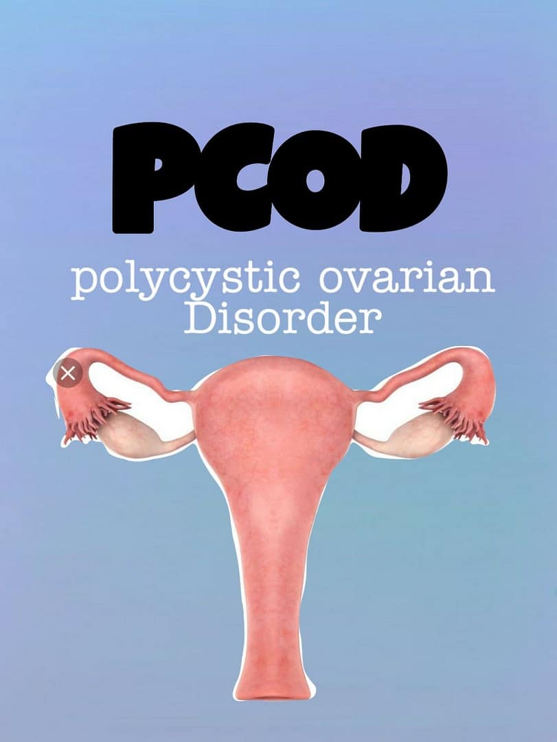You are currently viewing PCOD-A Manageable Lifestyle Disorder By Alternative Techniques”